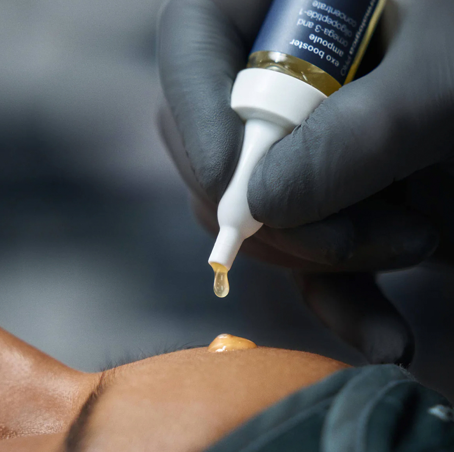 ExoBoosterMicroneedling1