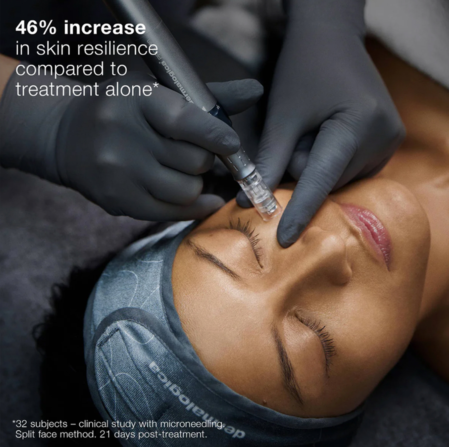 ExoBoosterMicroneedling3